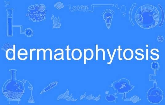 dermatophytosis