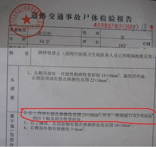 验尸报告
