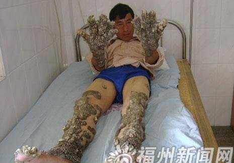 珊瑚人