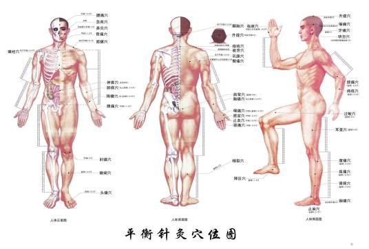 平衡针灸