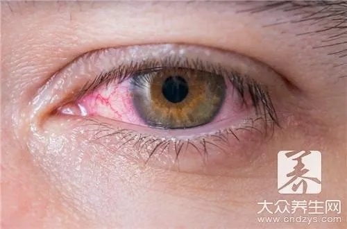 红血丝是怎么形成的