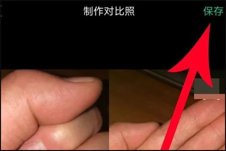 图片对比照