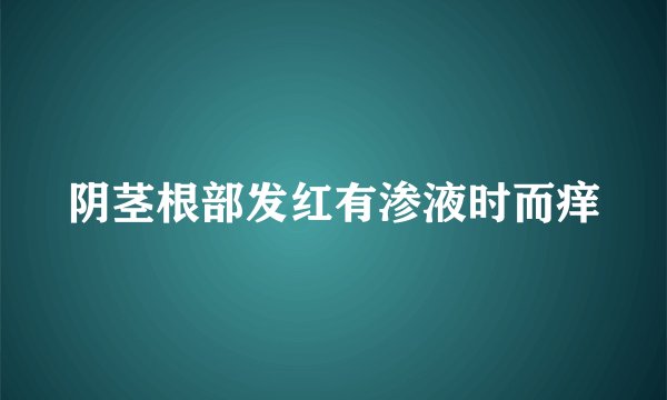阴茎根部发红有渗液时而痒