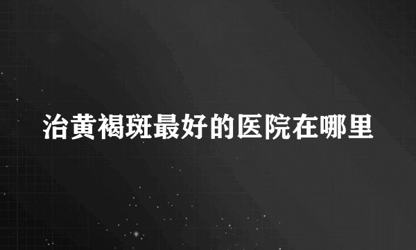 治黄褐斑最好的医院在哪里