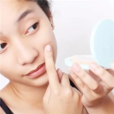 去痘印大概多少钱