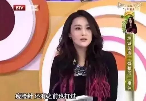 张馨予整容了吗?是演员敬业的体现吗?