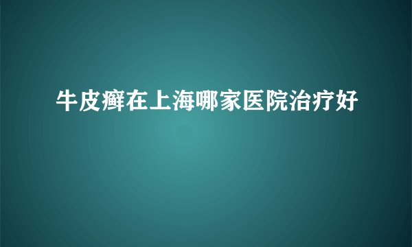 牛皮癣在上海哪家医院治疗好