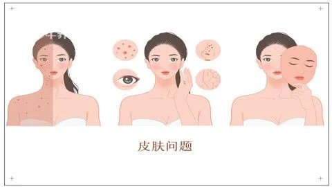 老年斑如何祛除
