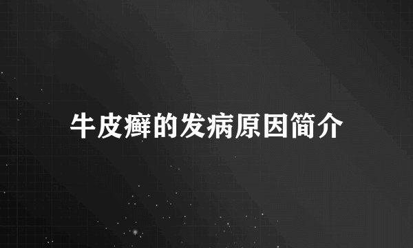 牛皮癣的发病原因简介