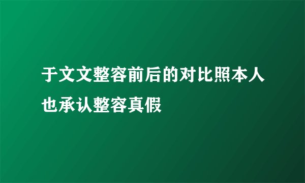 于文文整容前后的对比照本人也承认整容真假