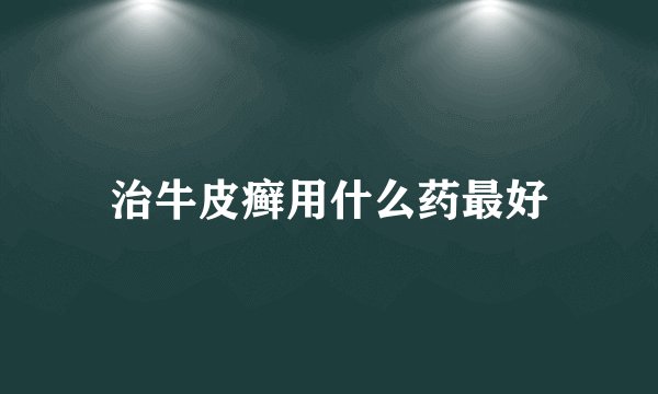 治牛皮癣用什么药最好