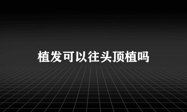 植发可以往头顶植吗