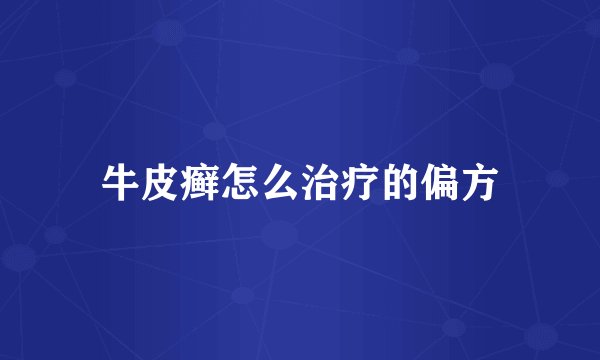 牛皮癣怎么治疗的偏方