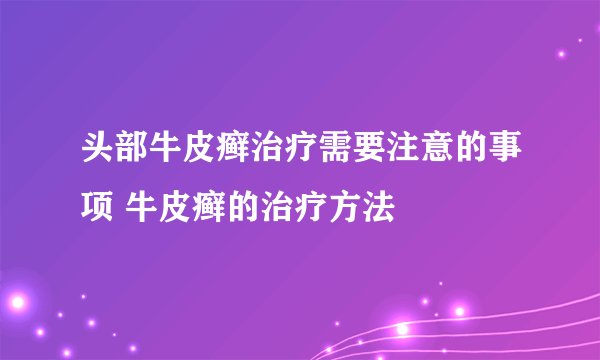头部牛皮癣治疗需要注意的事项 牛皮癣的治疗方法