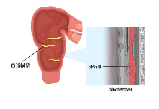 直肠位置图