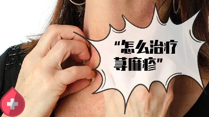 药疹的治疗方法