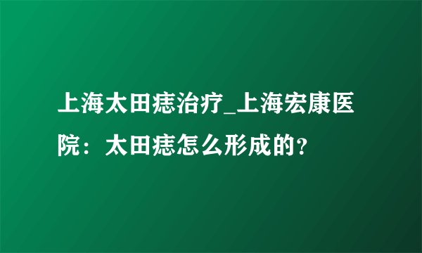 上海太田痣治疗_上海宏康医院:太田痣怎么形成的?