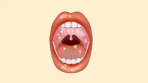 长期口角糜烂应该怎样治疗