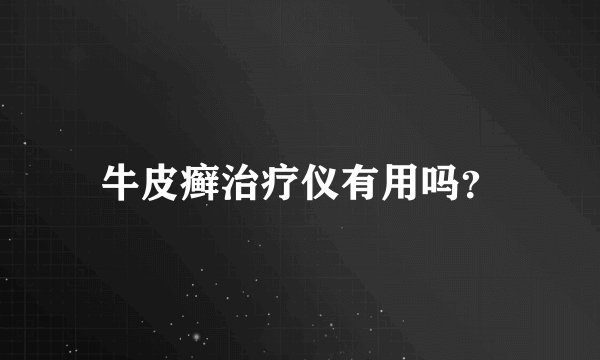 牛皮癣治疗仪有用吗？