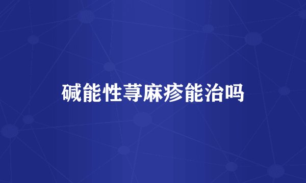 碱能性荨麻疹能治吗