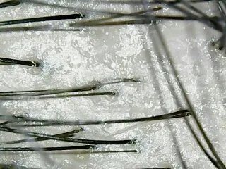 霸王防脱发好用吗?