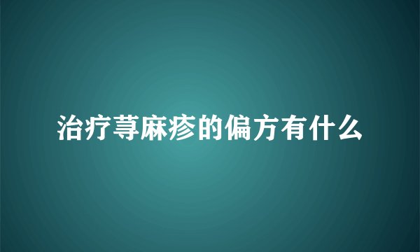 治疗荨麻疹的偏方有什么