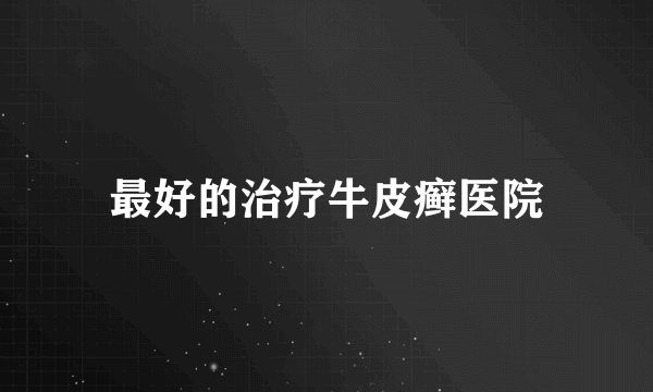 最好的治疗牛皮癣医院