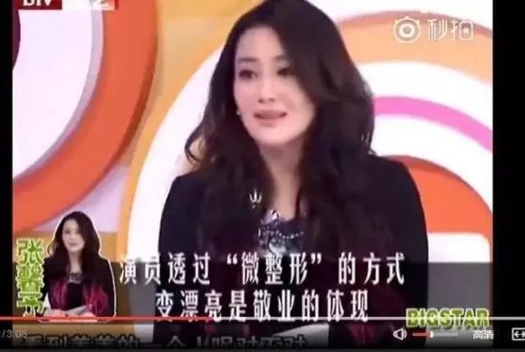 张馨予整容了吗?是演员敬业的体现吗?