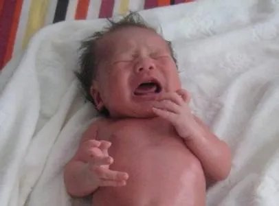 对于父母将婴儿放微波炉这个事件,孩子以后会有什么后遗症吗?