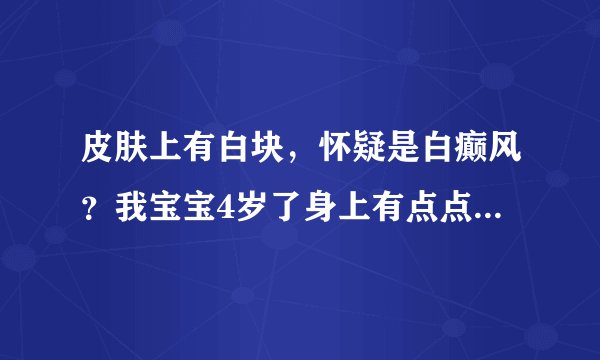 皮肤上有白块，怀疑是白癫风？我宝宝4岁了身上有点点白...
