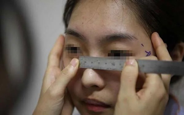 广州玻尿酸隆鼻医院哪里比较好