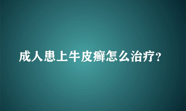 成人患上牛皮癣怎么治疗？