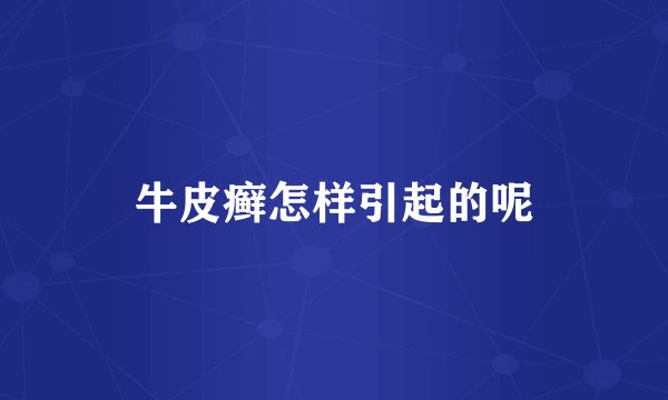 牛皮癣怎样引起的呢