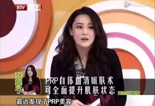 张馨予整容了吗?是演员敬业的体现吗?