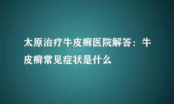 太原治疗牛皮癣医院解答：牛皮癣常见症状是什么
