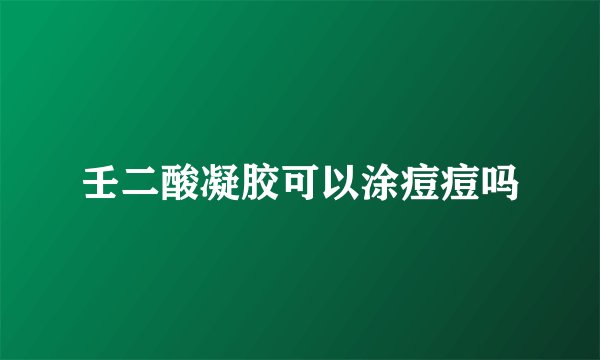 壬二酸凝胶可以涂痘痘吗