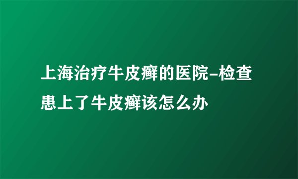 上海治疗牛皮癣的医院-检查患上了牛皮癣该怎么办