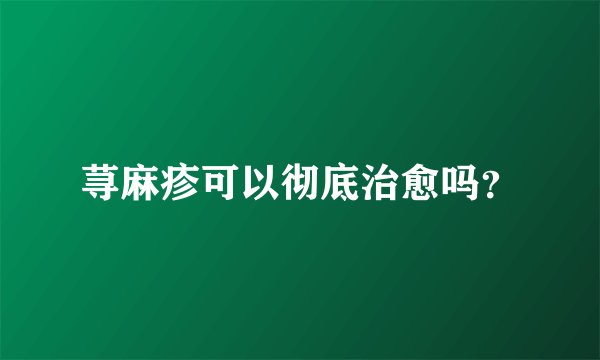 荨麻疹可以彻底治愈吗？