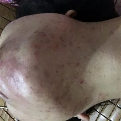 做祛痘哪里好