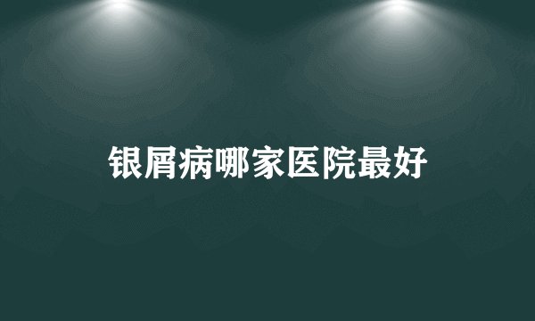 银屑病哪家医院最好