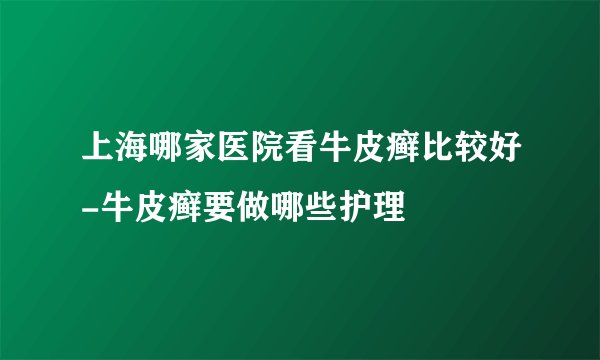 上海哪家医院看牛皮癣比较好-牛皮癣要做哪些护理