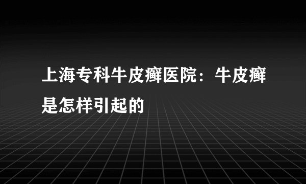 上海专科牛皮癣医院：牛皮癣是怎样引起的